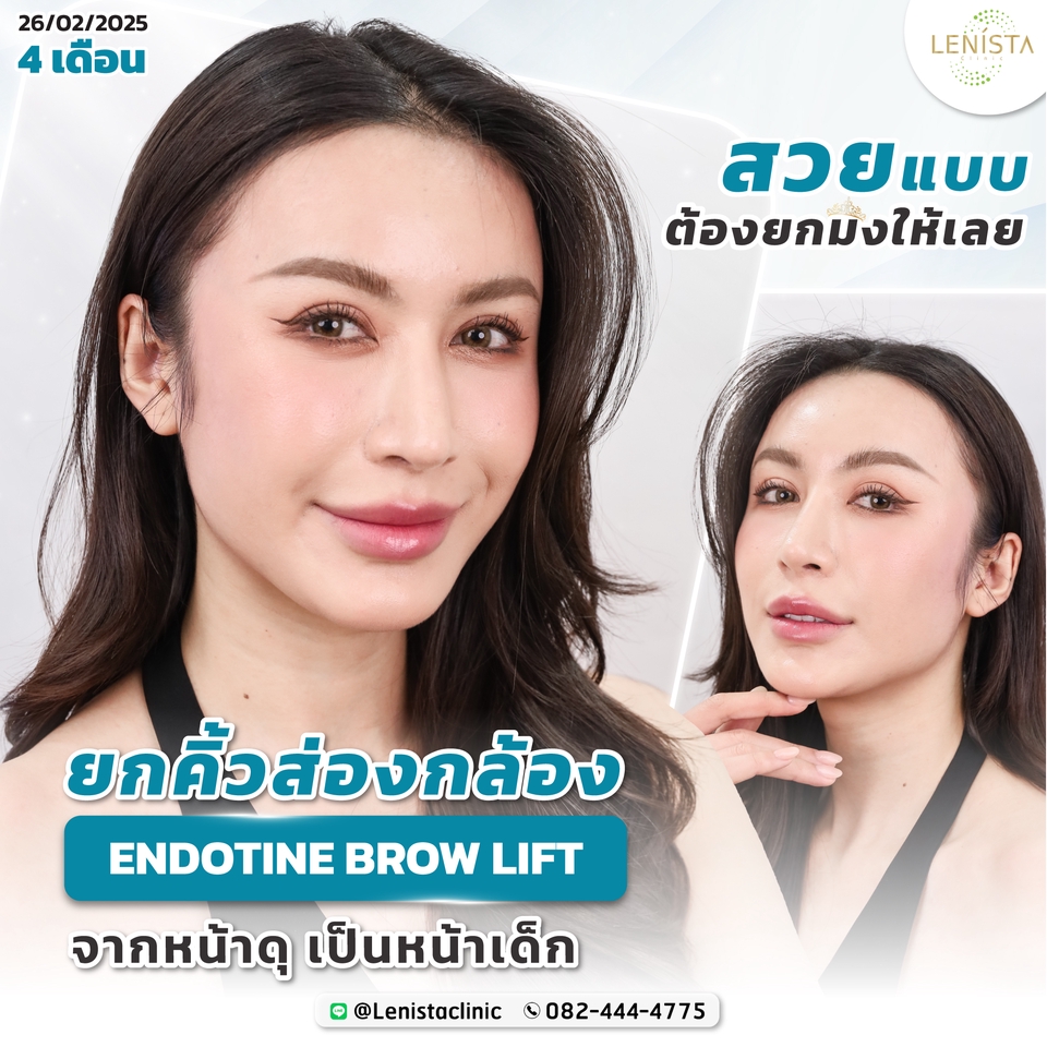 Banner โฆษณา - รับออกแบบภาพกราฟิก Banner โฆษณา - 27