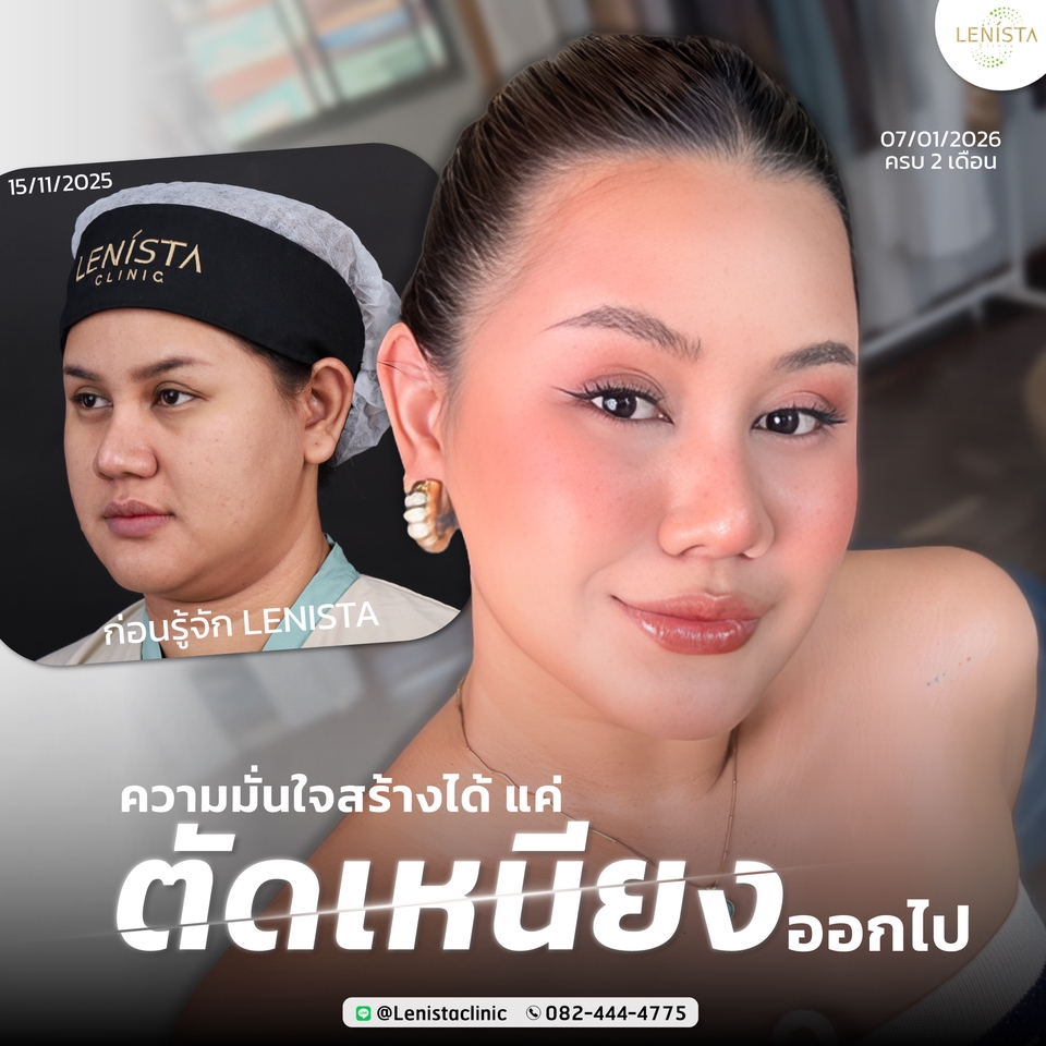 Banner โฆษณา - รับออกแบบภาพกราฟิก Banner โฆษณา - 21